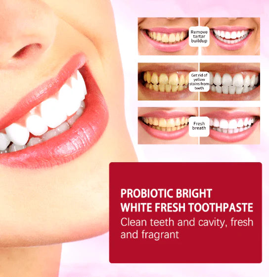 Sp-4 Toothpaste (120g) - معجون أسنان Sp-4 (120 جرام)